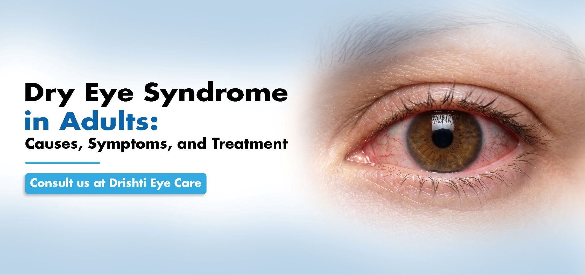 Dry Eye Syndrome in Adults: Causes, Symptoms, and Treatment | Drishti Eye Care System