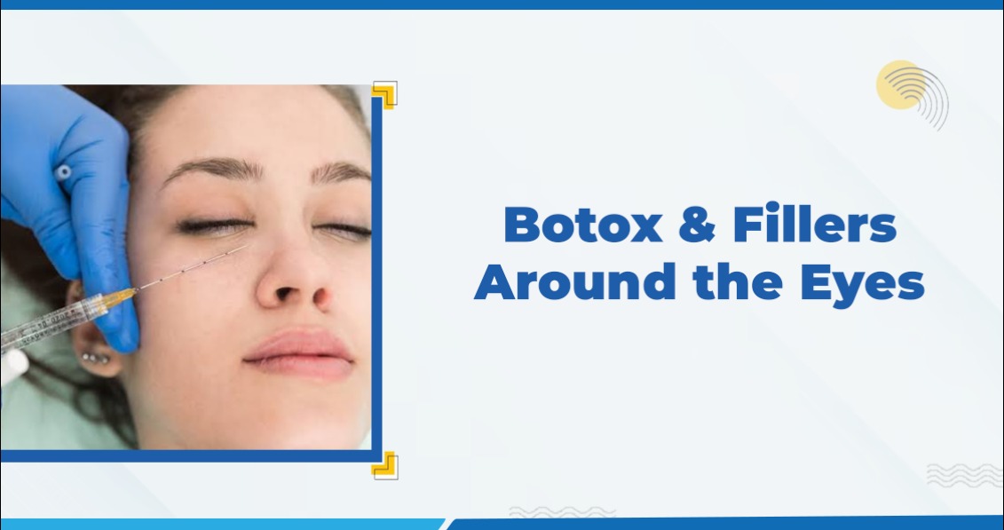 Botox and Fillers Around the Eyes