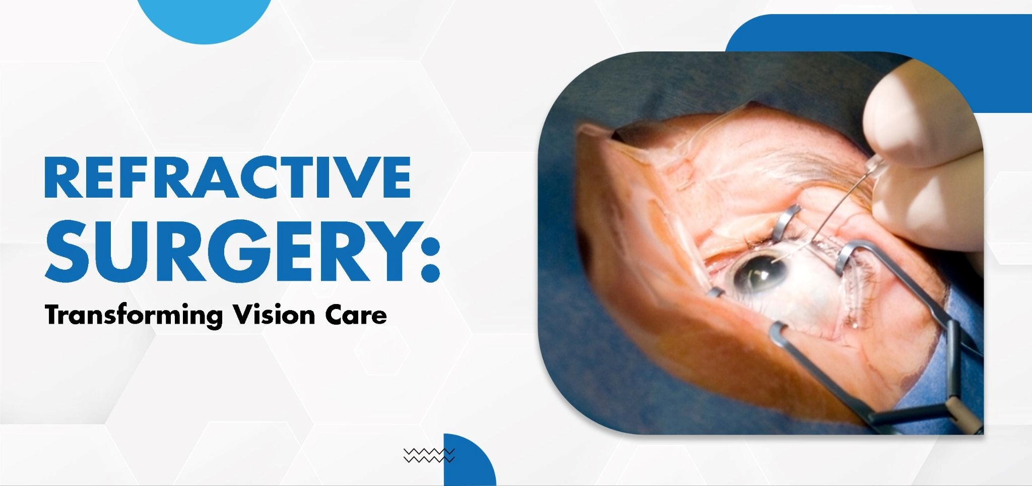 Refractive Surgery: Transforming Vision Care | Drishti Eye Care Team